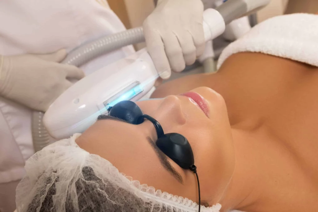 Laser Treatment in Dallas, TX