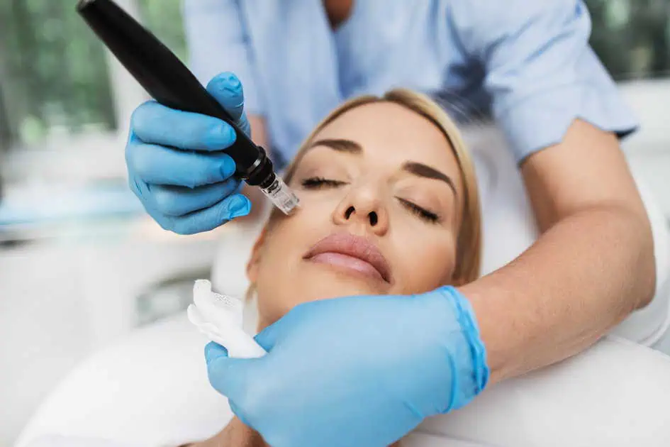 SkinPen Microneedling Treatment by Lily Med Spa in Dallas, Texas