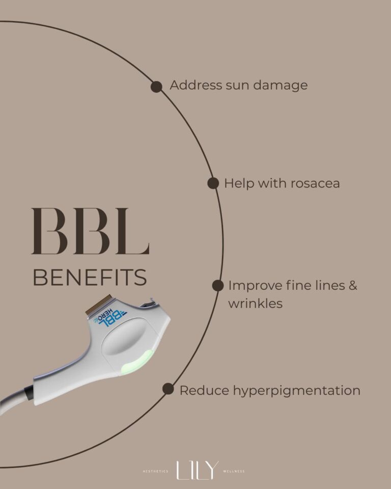 BBL Benefits
